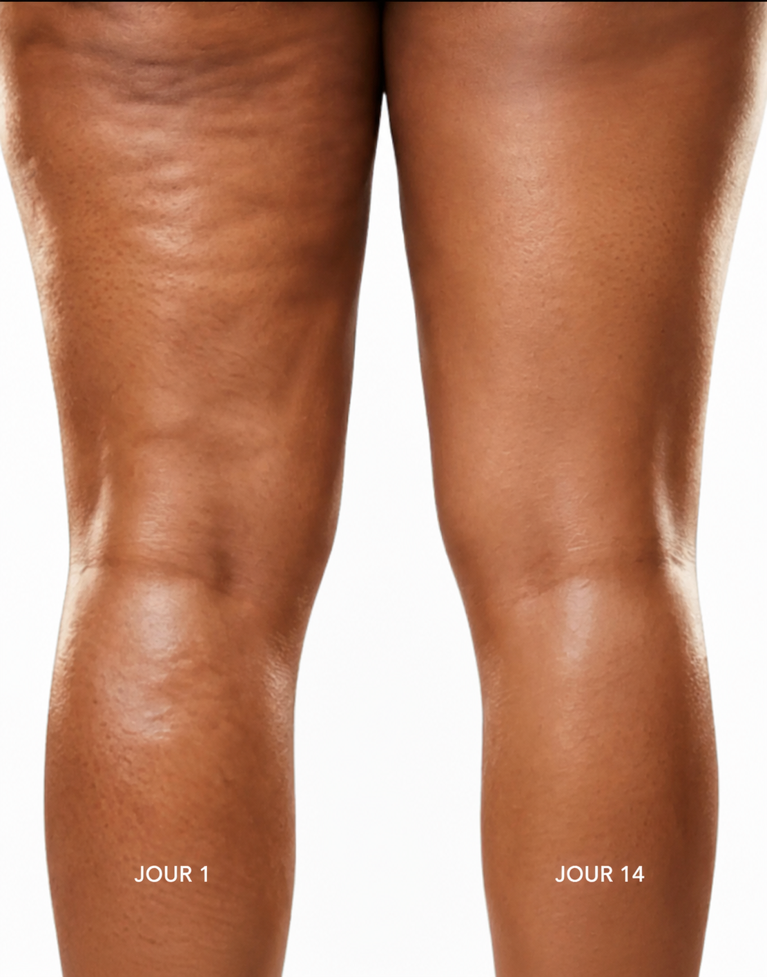 Bandly Sculpt 3 Pro